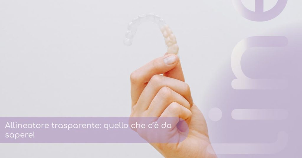 allineatore trasparente