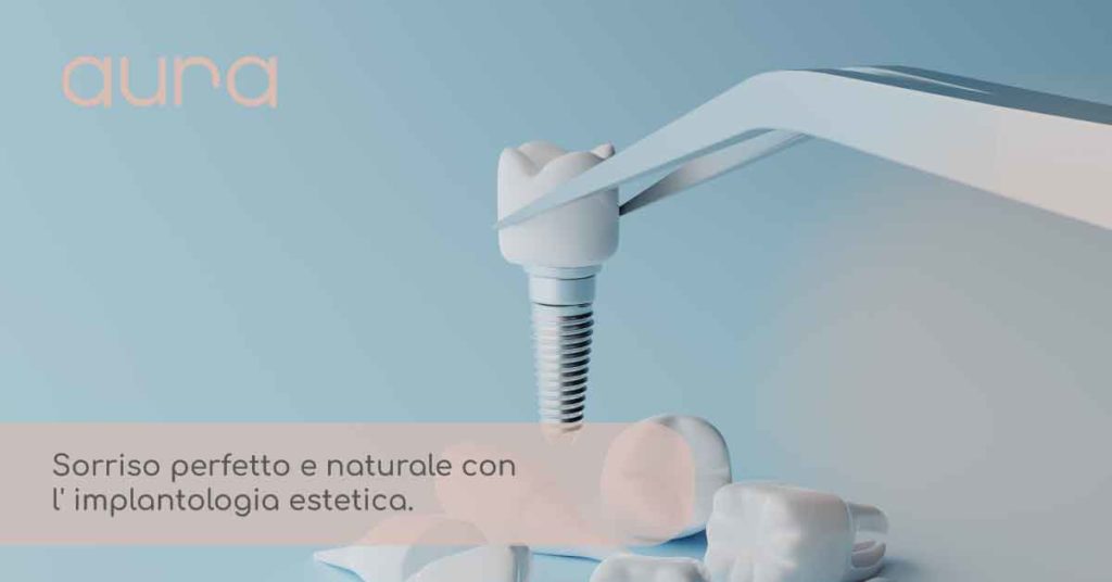 implantologia estetica